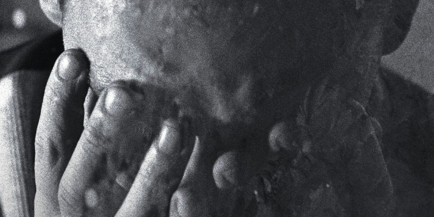 A black and white photograph of a man holding his head in his hands.